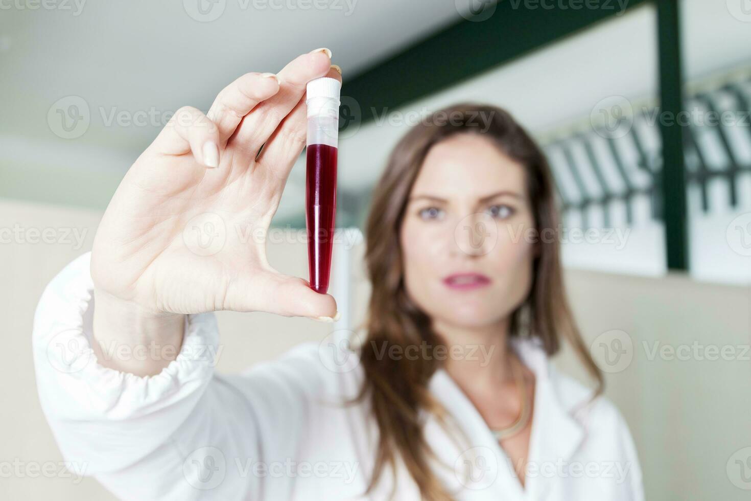 female doctor examines blood tube in laboratory photo