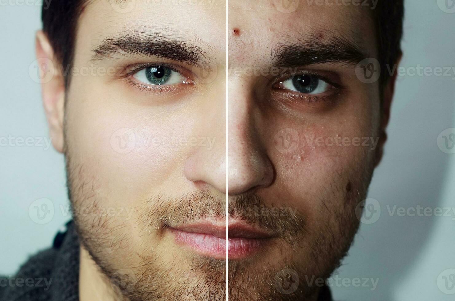 antes de y después cosmético operación. joven bonito hombre retrato foto