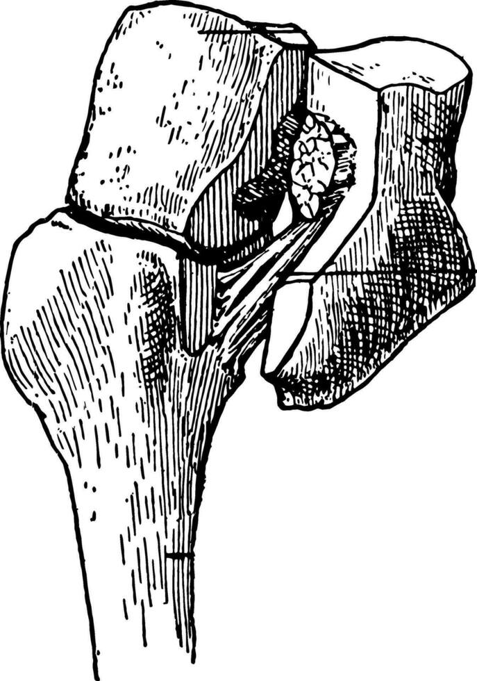 Ligament of Lisfranc, vintage illustration. vector