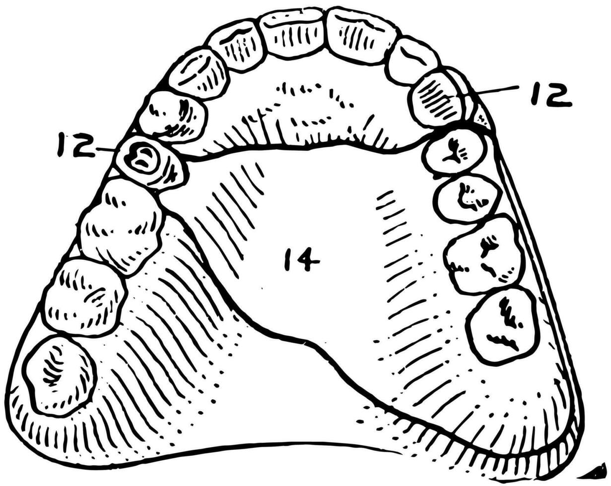 dental anclaje dentadura Clásico ilustración. vector