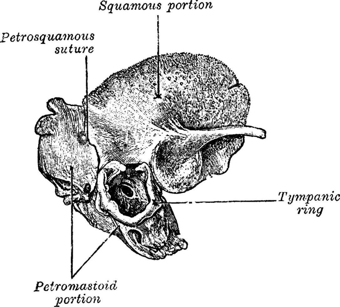 Outer Aspect of Temporal Bone at Birth, vintage illustration. vector
