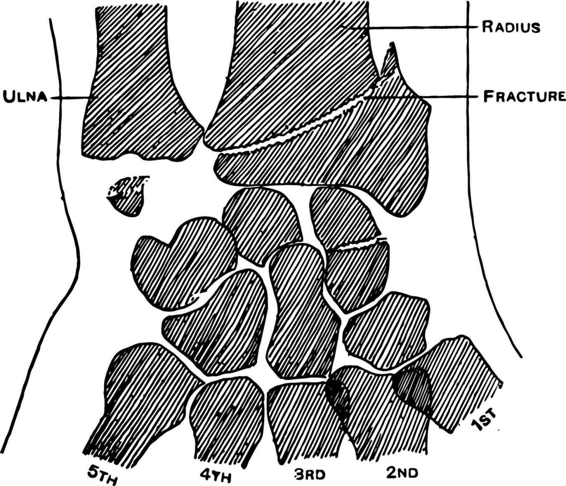 Colle Fraction of the Radius, vintage illustration. vector