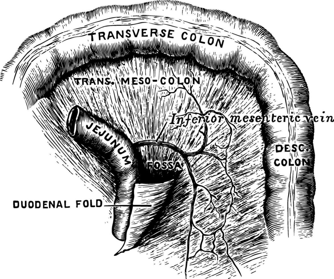 Duodeno-Jejunal Fossa, vintage illustration. vector