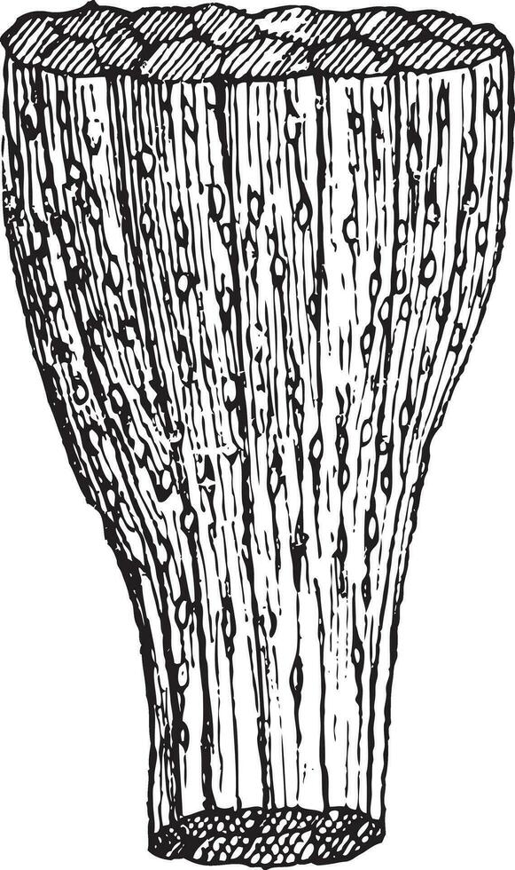 Trichinosis, vintage engraving vector