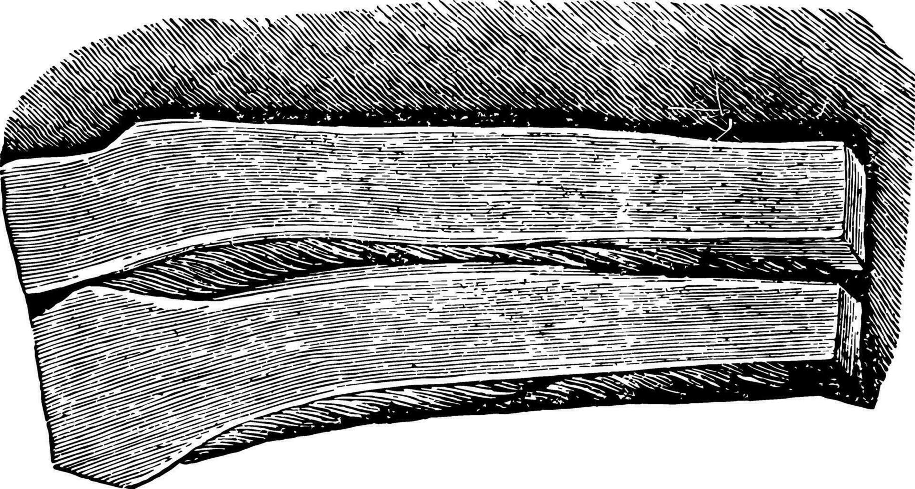 Cartilage Portion in Section, vintage illustration. vector