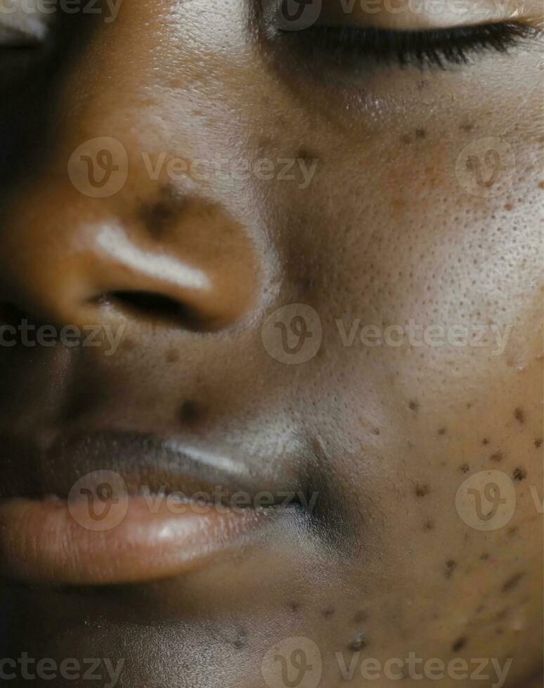 AI generated a face with pimples, blemishes and acne photo