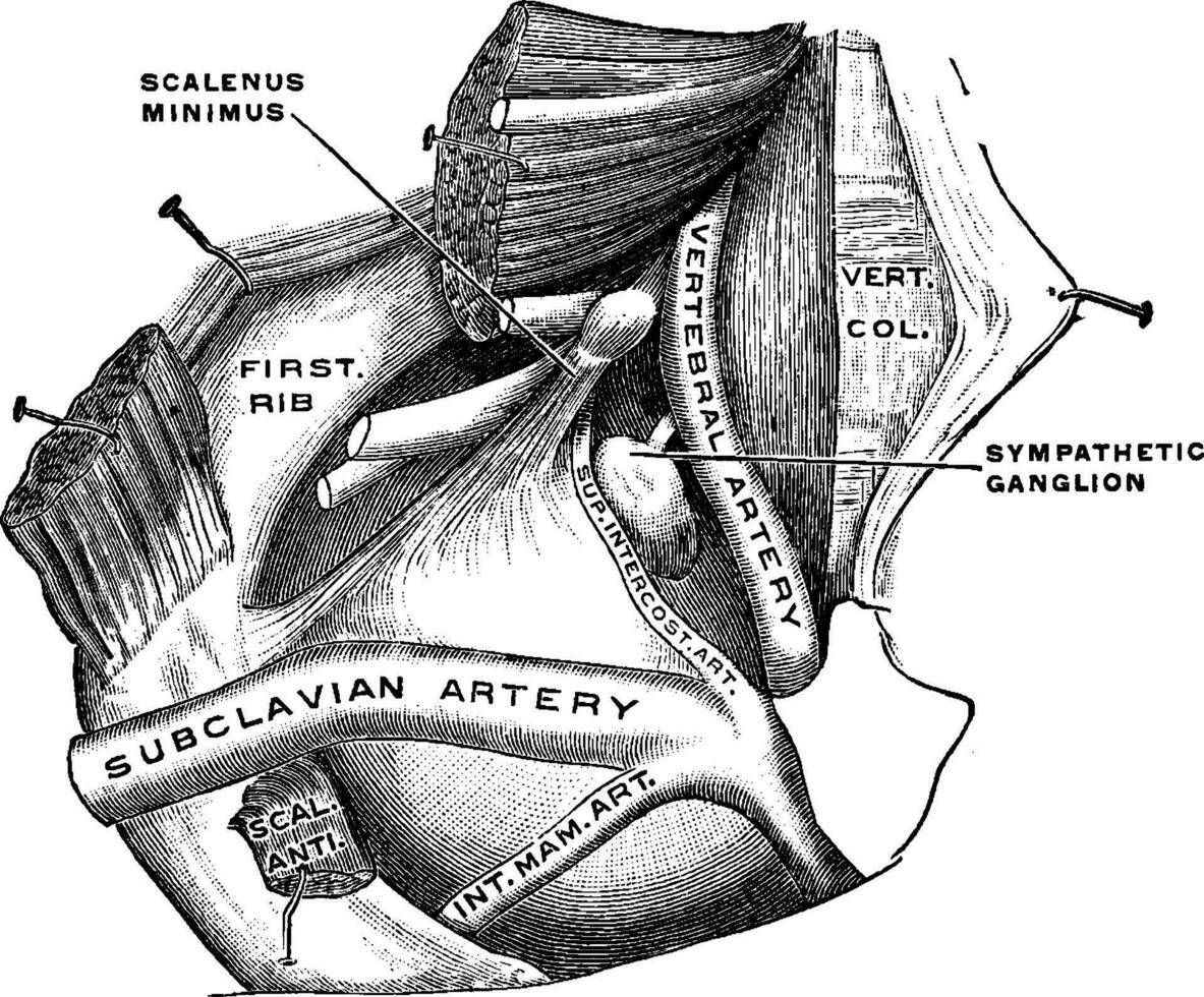 Pleura, vintage illustration. vector