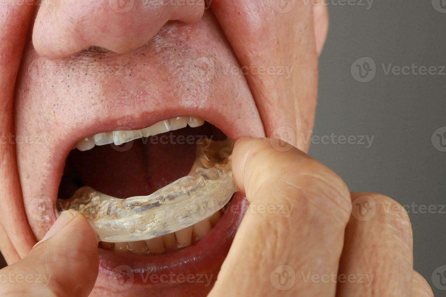 Older Mature Man putting in a night Guard in his mouth to prevent grinding photo