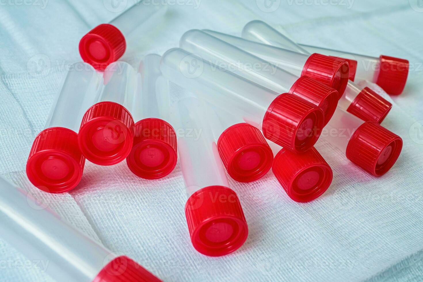 Plastic test tubes with caps for the collection of samples. Sampling tubes for laboratory examination. photo