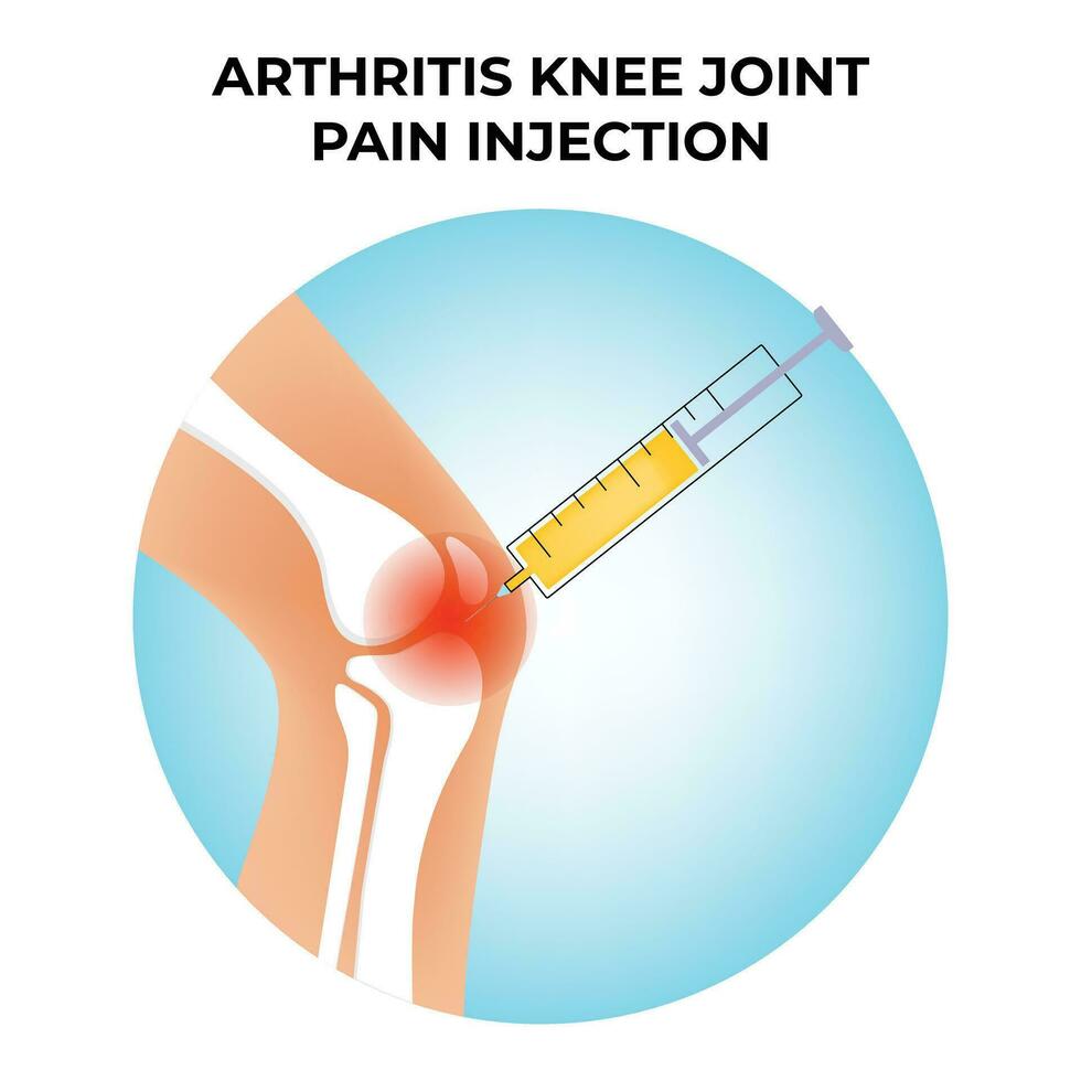 artritis rodilla articulación dolor inyección vector diseño ilustración