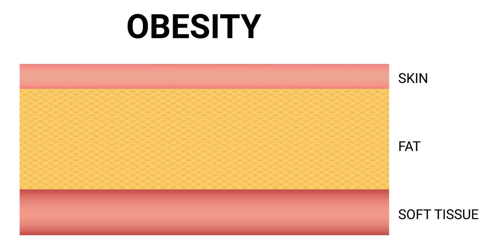 obesidad Ciencias diseño vector ilustración
