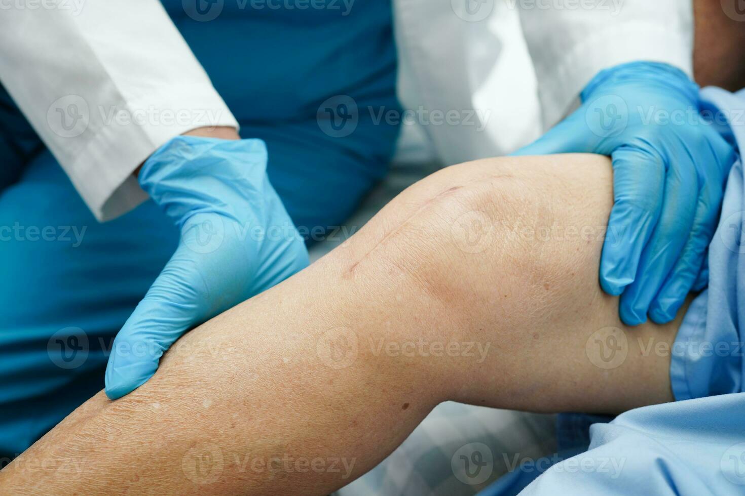 Doctor checking Asian elderly woman patient with scar knee replacement surgery in hospital. photo