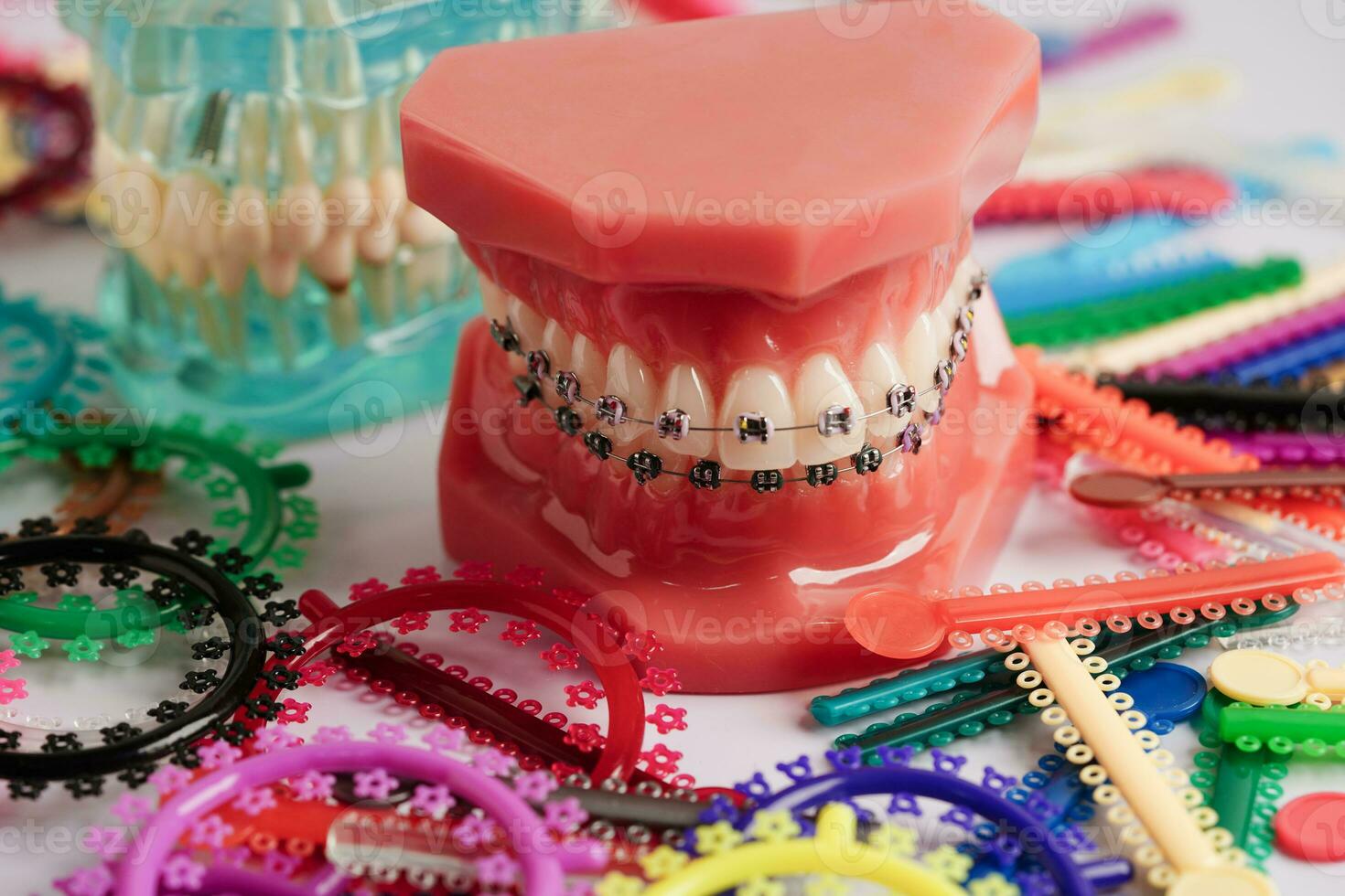 Orthodontic ligatures rings and ties, elastic rubber bands on orthodontic braces, model for dentist studying about dentistry. photo