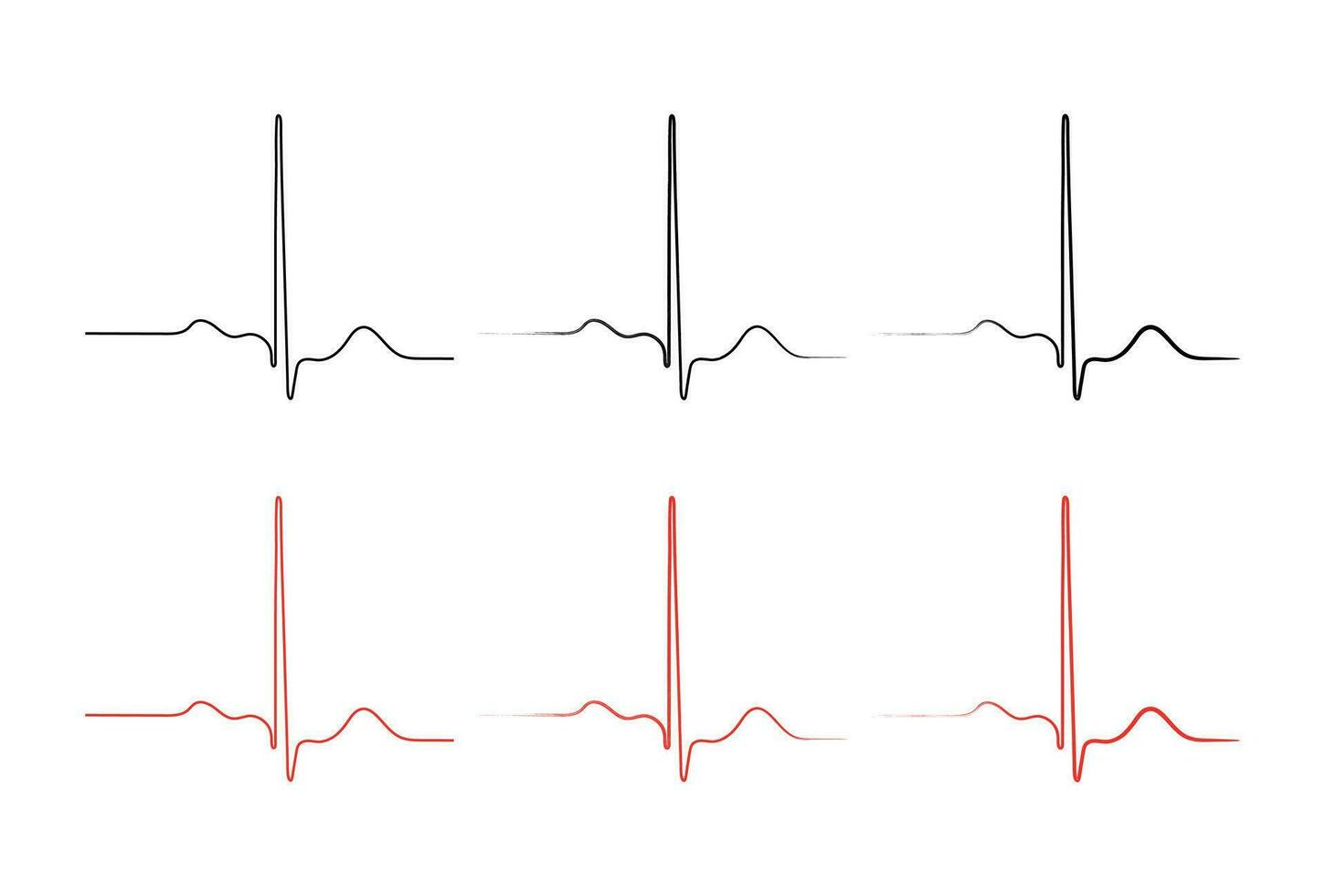 Ventricular repolarization, Cardiac cycle, ECG of heart in normal sinus rhythm, QT interval of ECG. vector