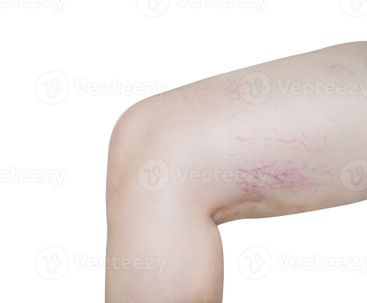 capillary pattern on legs PNG transparent