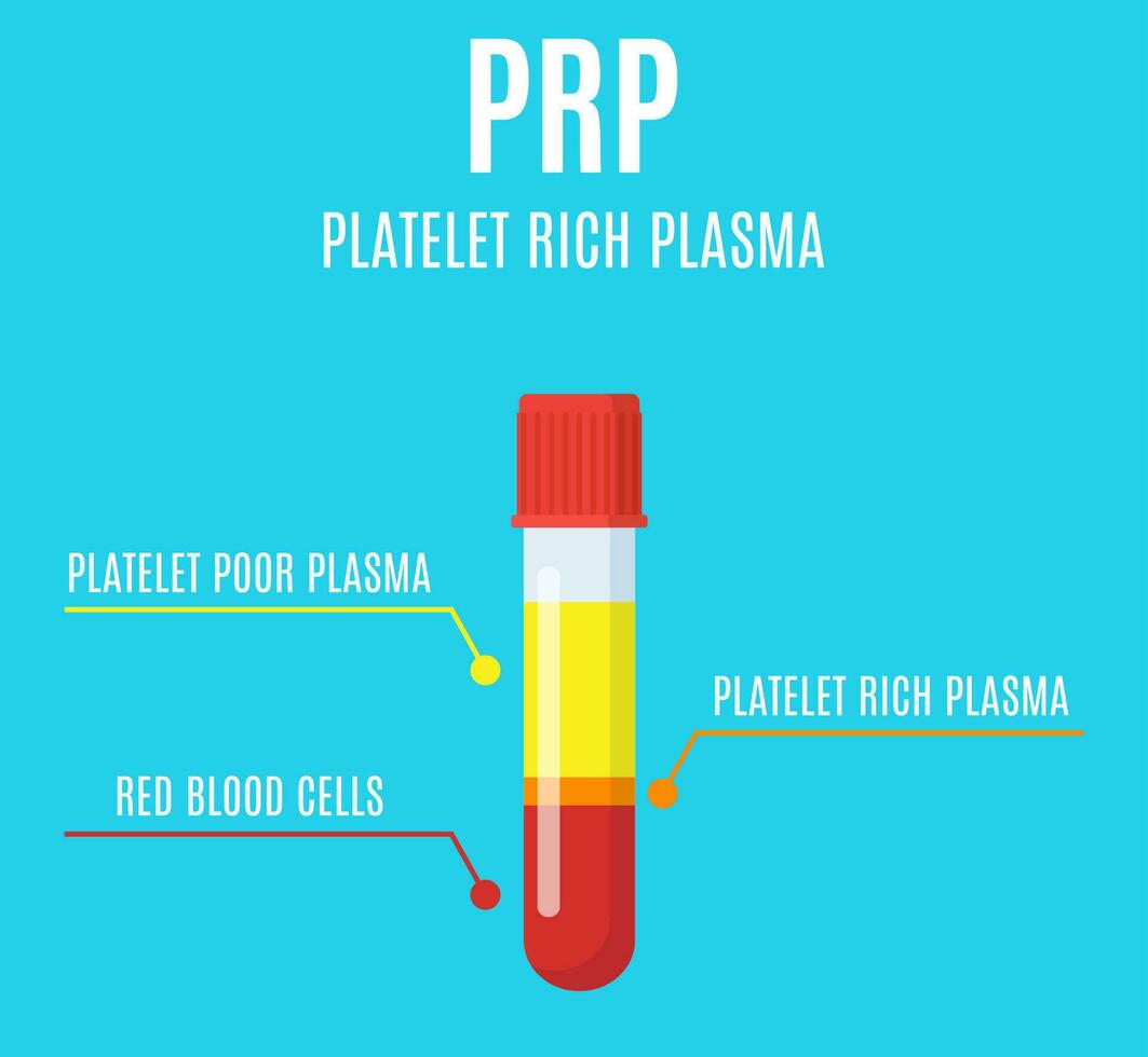 Test tube filled with blood after centrifuge for PRP injection procedures. Platelet-rich plasma laboratory equipment. Regenerative medicine concept. Vector illustration in flat style