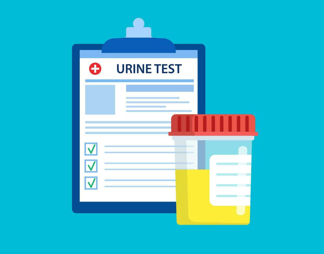 urine test Plastic jar and medical lab analysis form list with results data. Medical urine test records concept. Chemical laboratory analysis. Vector illustration in flat style