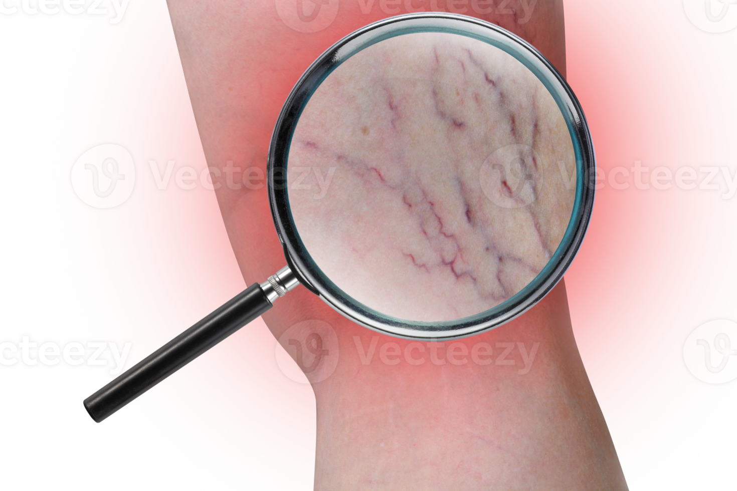 Leg capillary magnifier PNG transparent