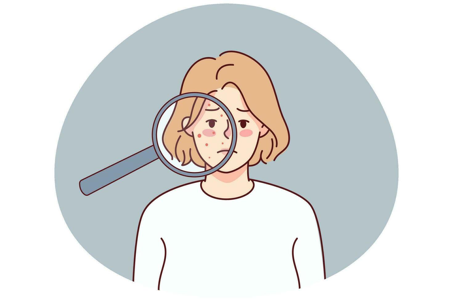 Unhappy woman with acne on face under magnifying glass. Upset young female suffer from skincare problems. Dermatology and cosmetology. Vector illustration.