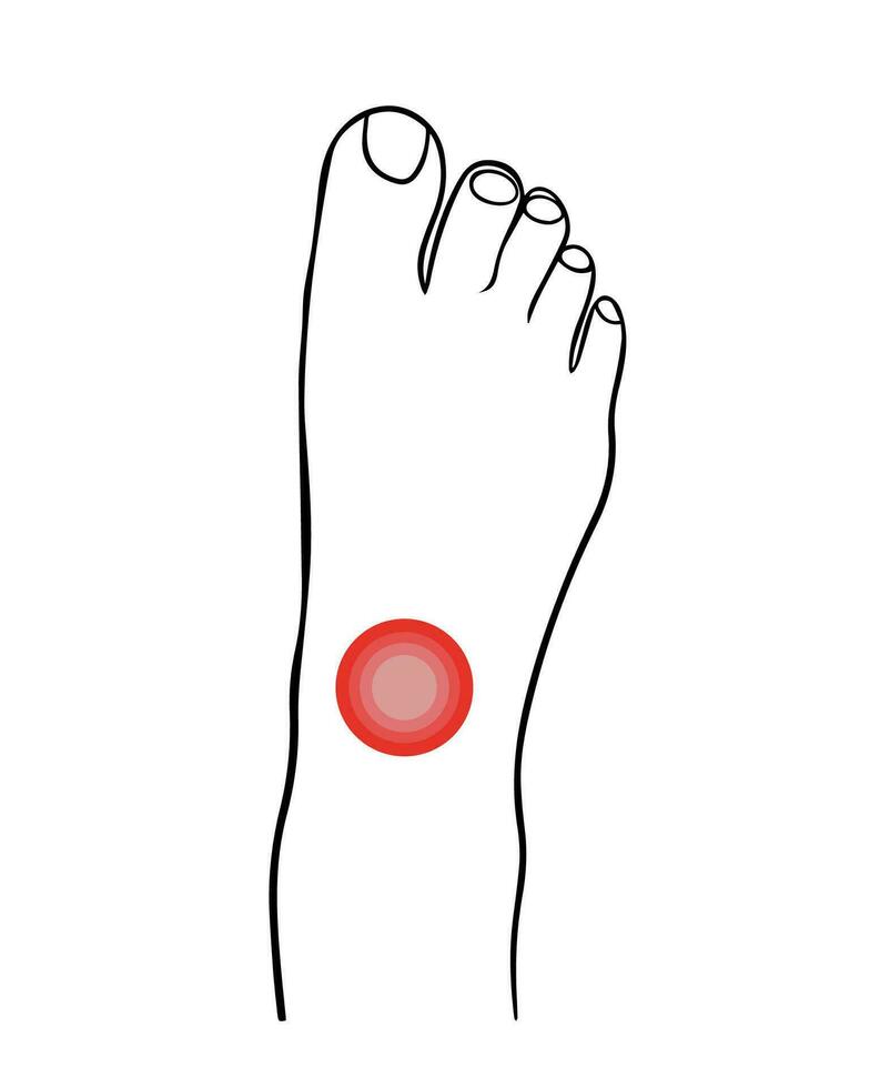 Vector isolated illustration of ankle pain.