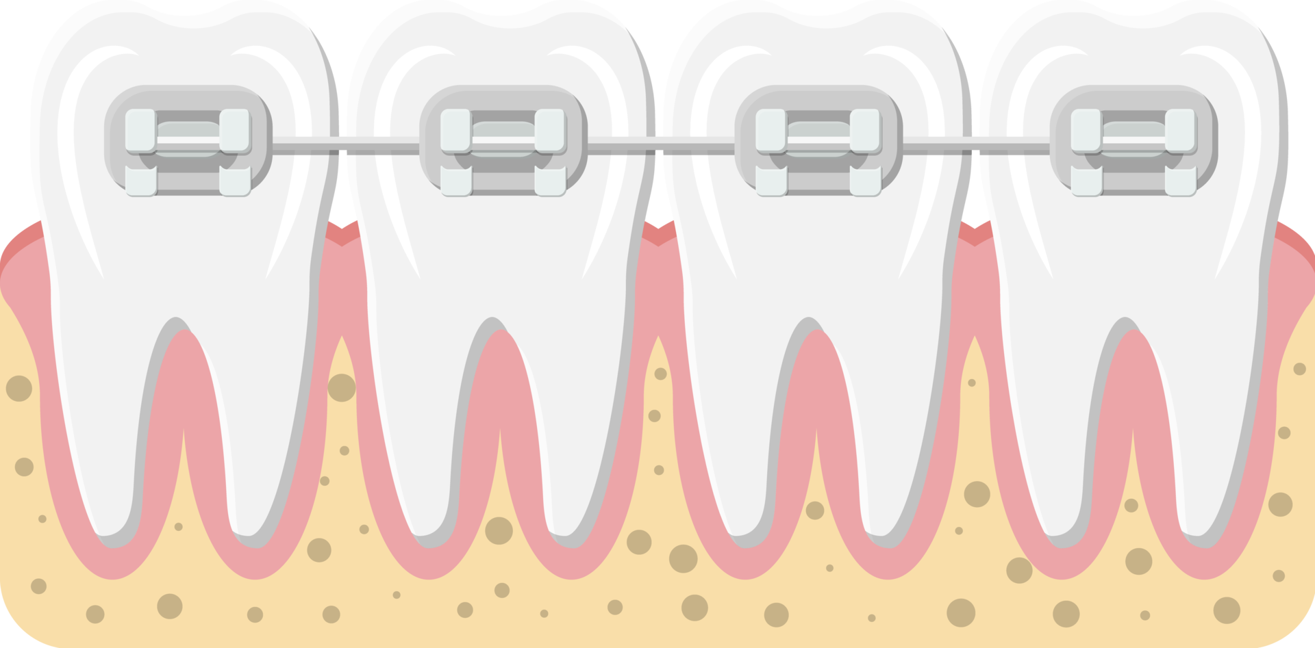 Teeth braces, orthodontics and dentistry 35856566 PNG