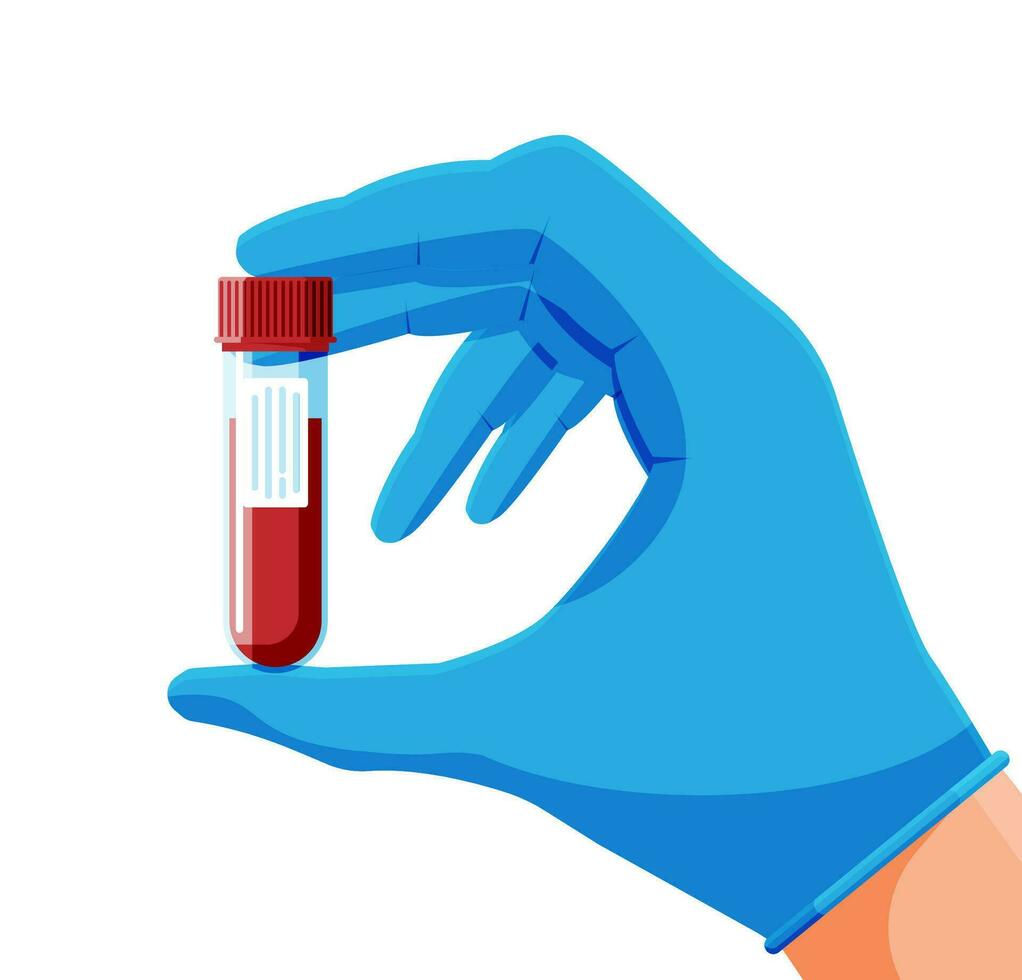 Test Tube with Blood Sample in Hand of Doctor Isolated. General Blood Analysis. Laboratory Container with Red Liquid. Medical Plastic Bag. Research, Medical Analysis. Cartoon Flat Vector Illustration