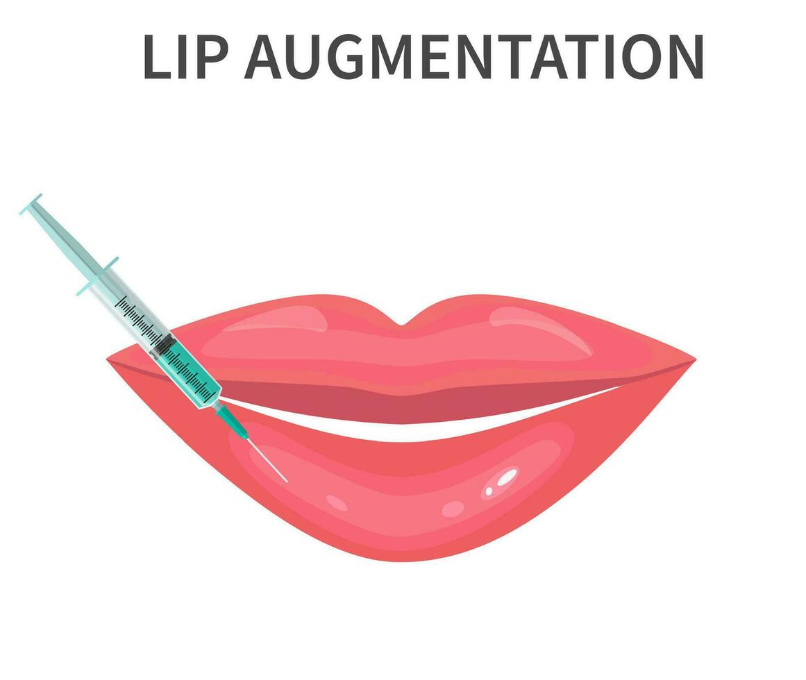 Lips injection isolated over white background. Lip Augmentation. Vector illustration in flat style