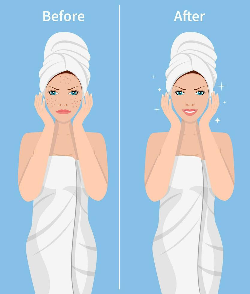 mujer piel cuidado. antes de y después cara tratamiento. facial piel problemas. spa belleza y salud concepto. vector ilustración en plano estilo