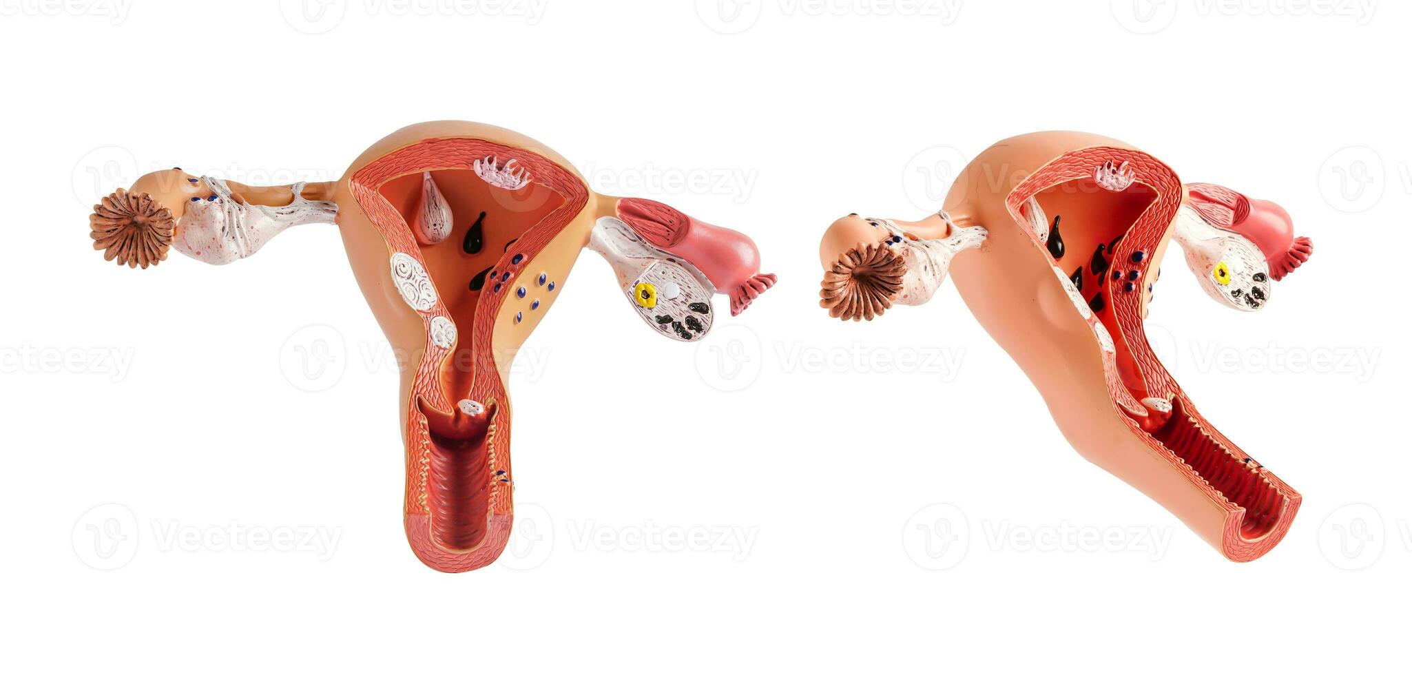 Uterus model isolated on white background with clipping path, doctor holding anatomy model for study diagnosis and treatment in hospital. photo