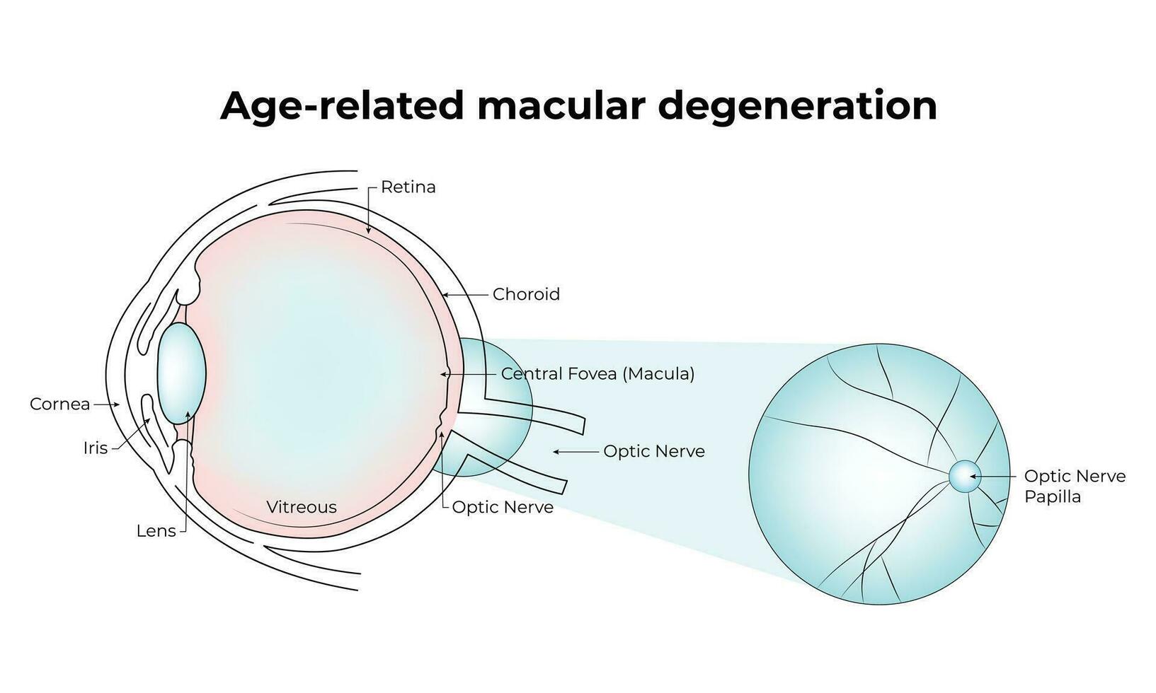 Age Releted Macular Degeneration Science Design Vector Illustration