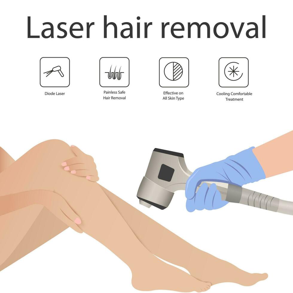 Laser hair removal of the skin layer and follicle for beauty and smoothness of the body. Hair removal procedure vector