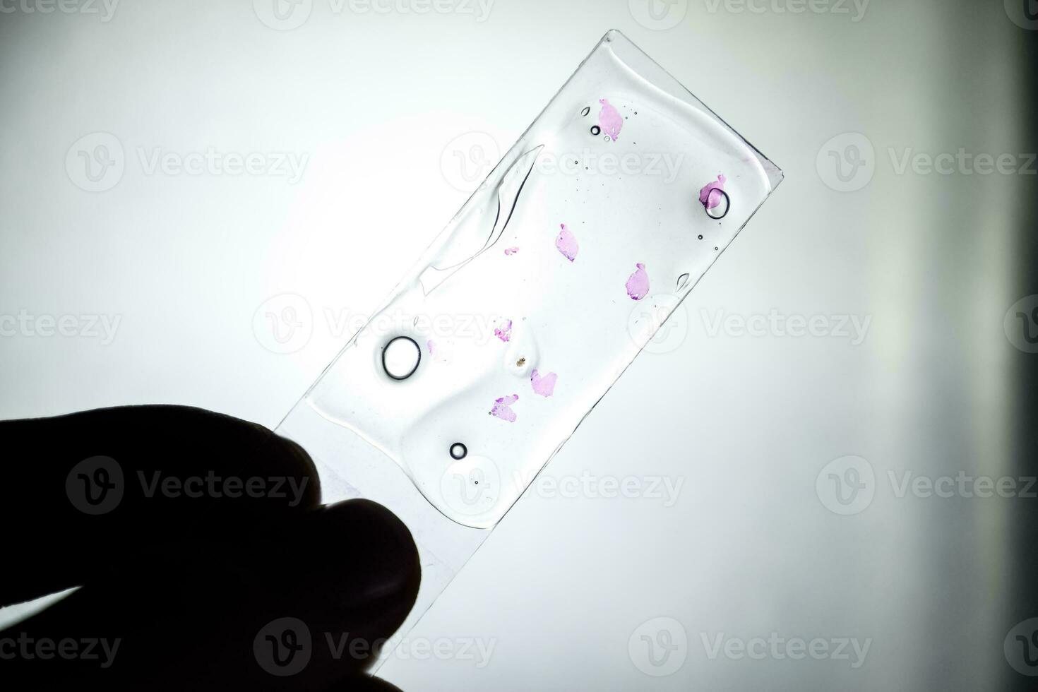 Slices of the tumor under glass. Histological examination of tumor cells for the presence of cancer photo