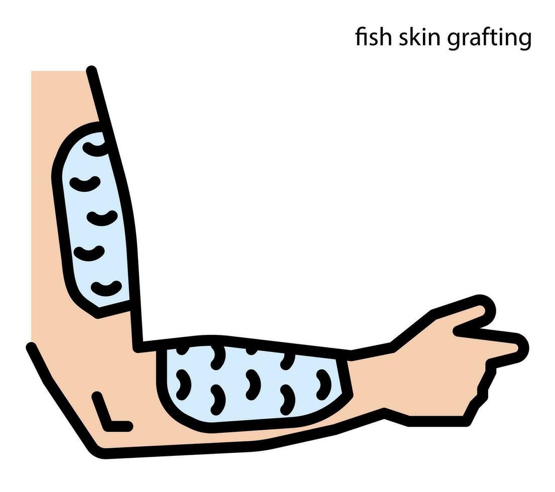 Fish skin grafting for wound healing vector