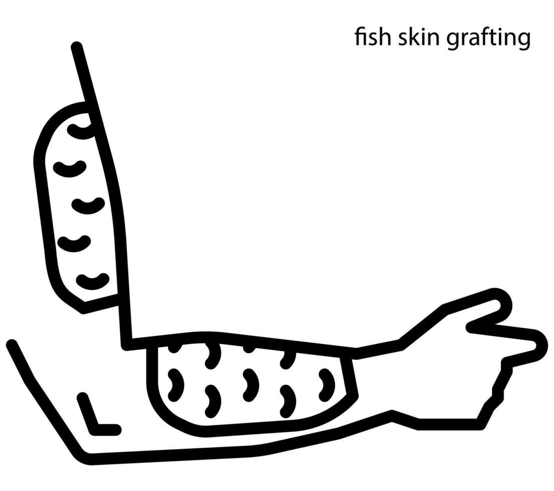 Fish skin grafting for wound healing vector