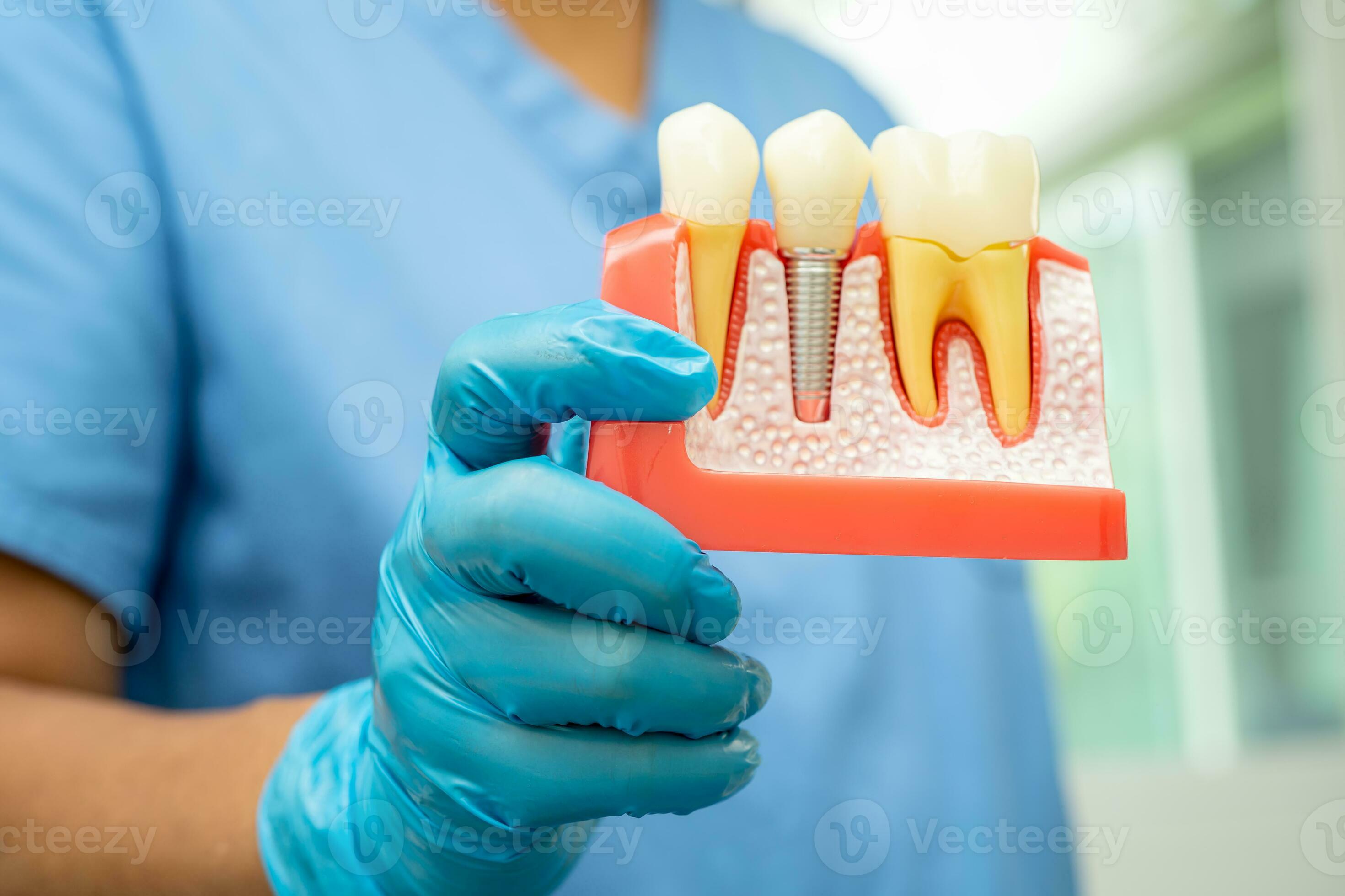 Dental implant, artificial tooth roots into jaw, root canal of dental
