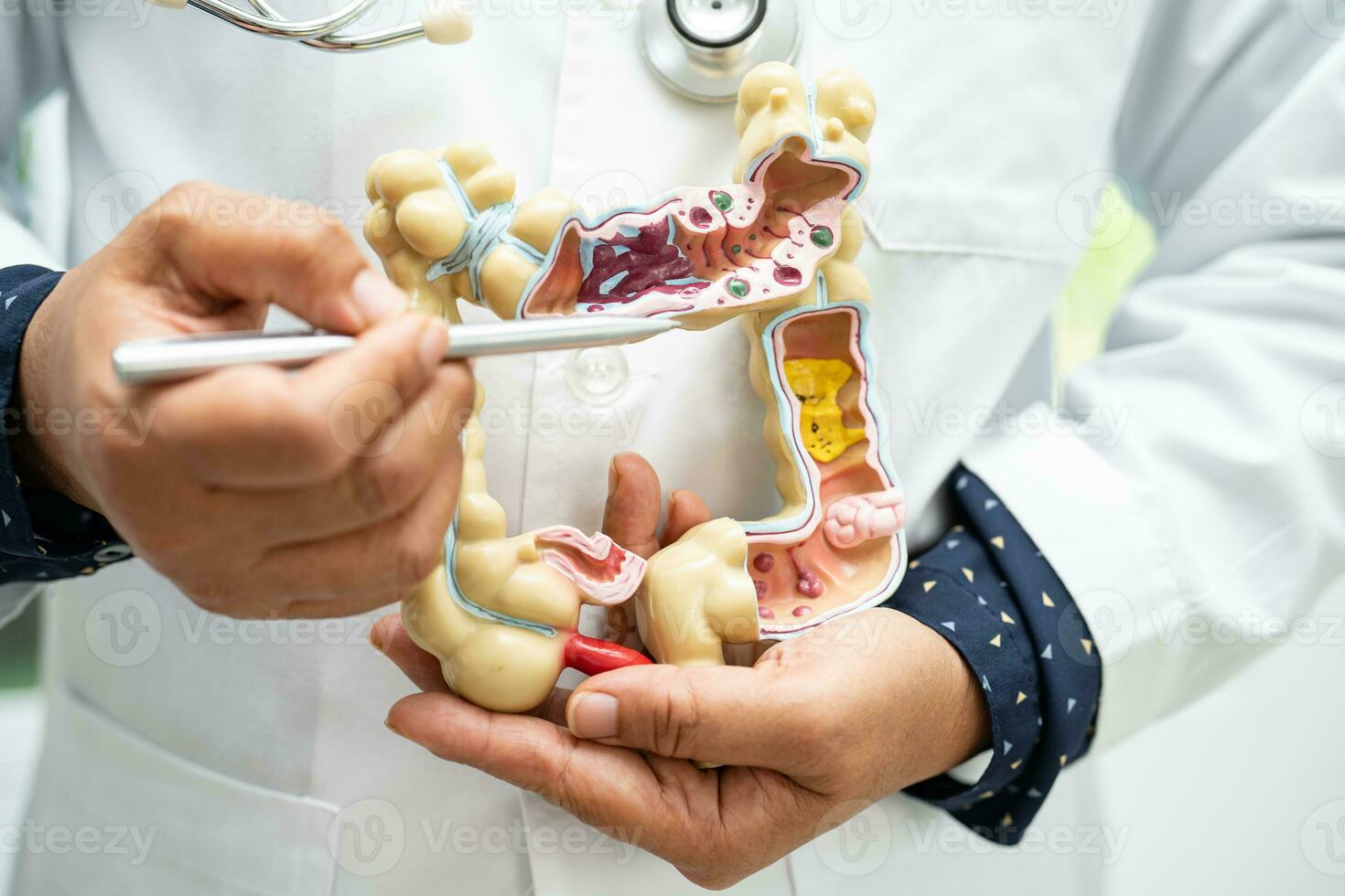 Intestine, appendix and digestive system, doctor holding anatomy model for study diagnosis and treatment in hospital. photo