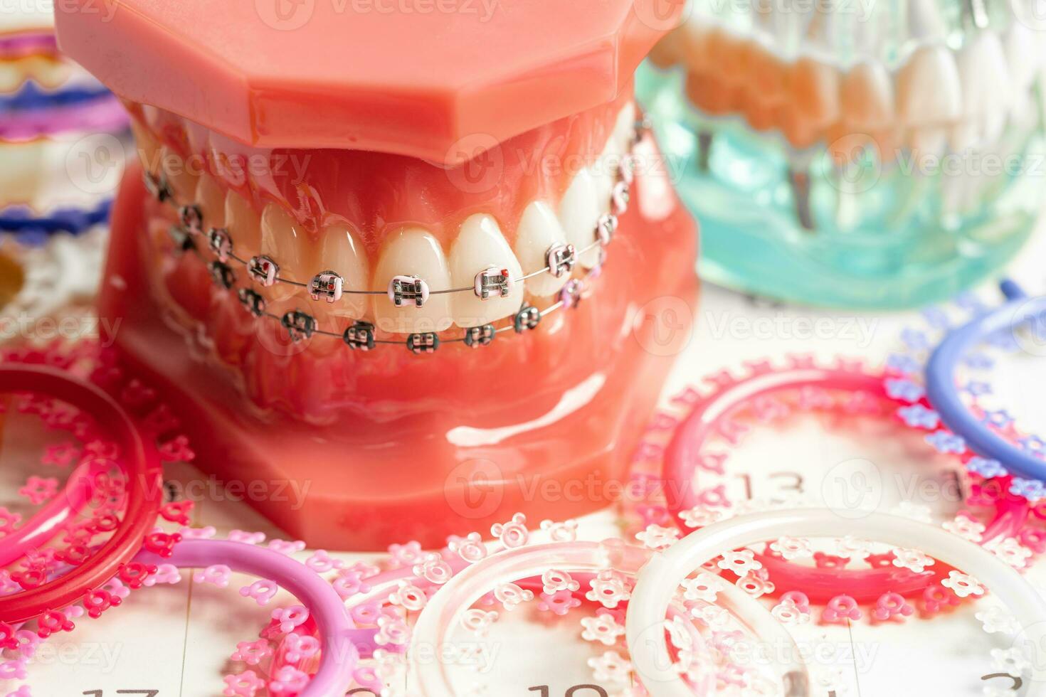 Orthodontic ligatures rings and ties, elastic rubber bands on orthodontic braces, model for dentist studying about dentistry. photo