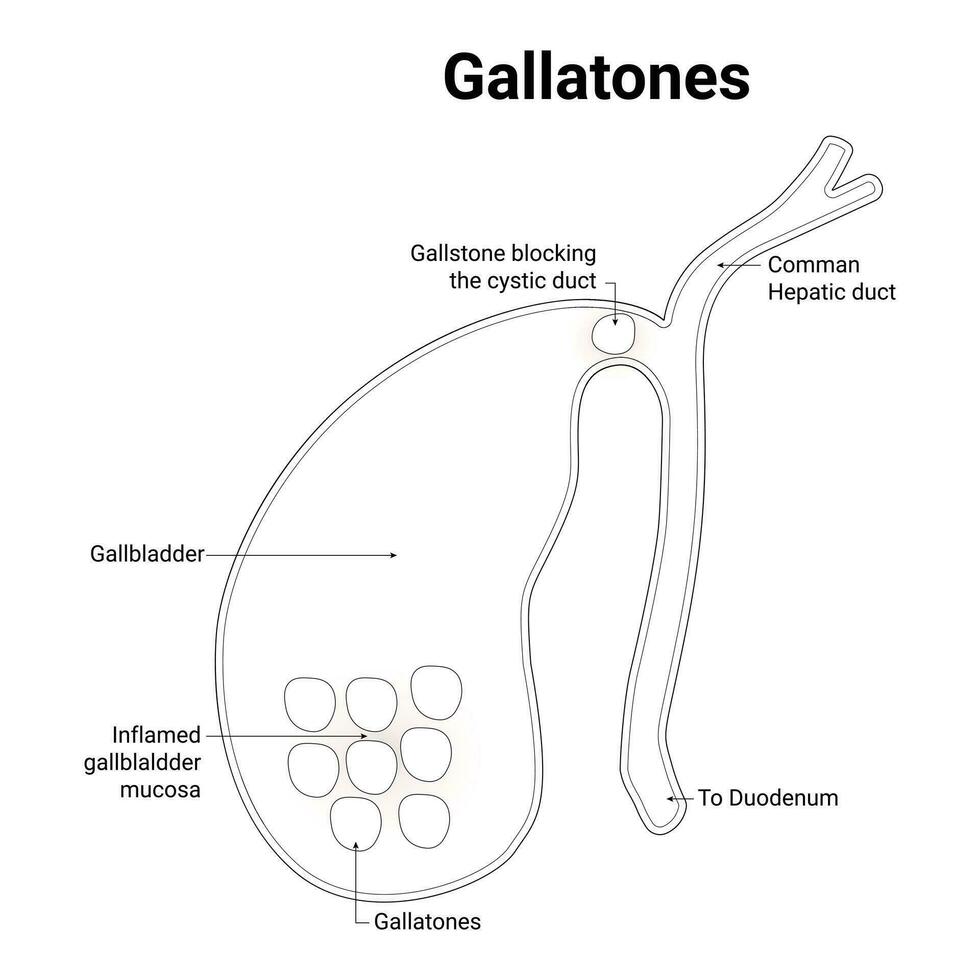 Gallatones Science Design Vector Illustration Diagram