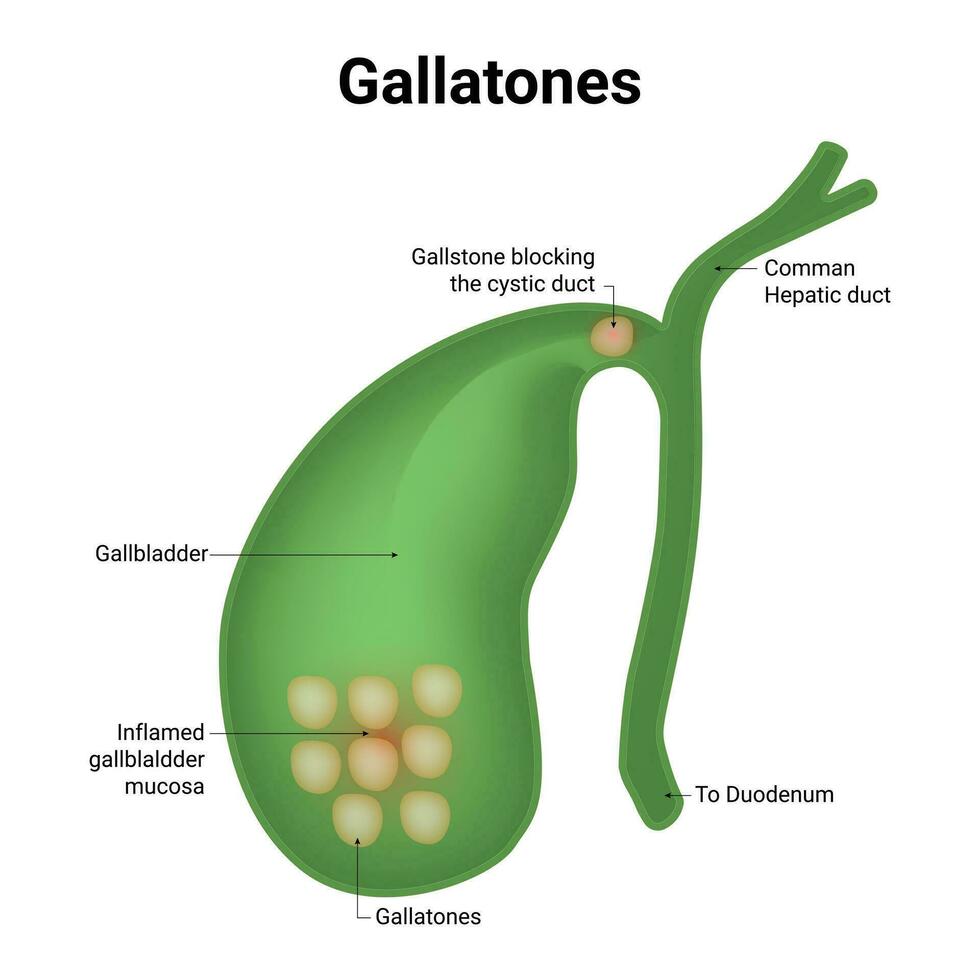 Gallatones Science Design Vector Illustration Diagram