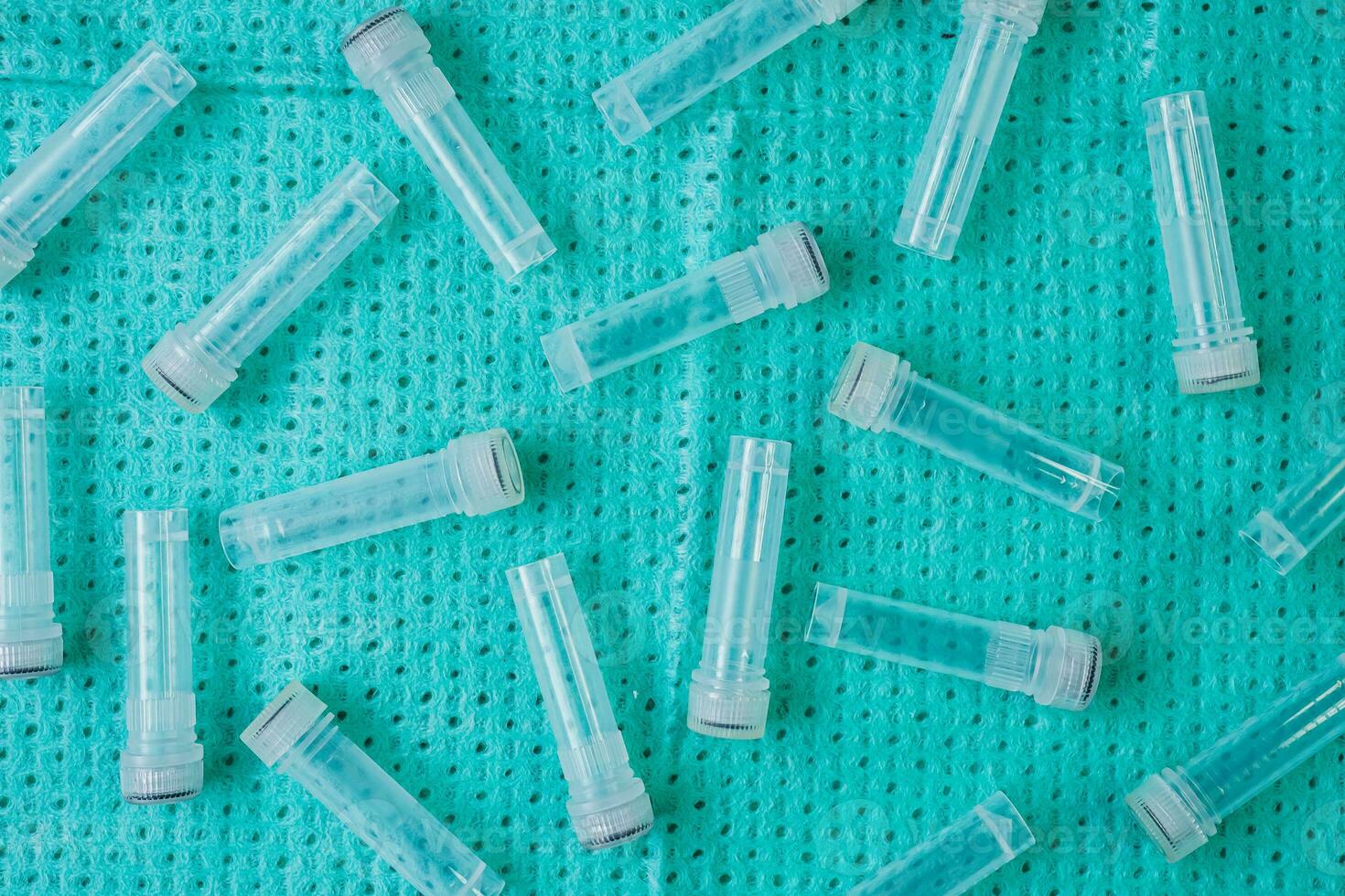 Plastic test tubes with caps for the collection of samples. Sampling tubes for laboratory examination. photo