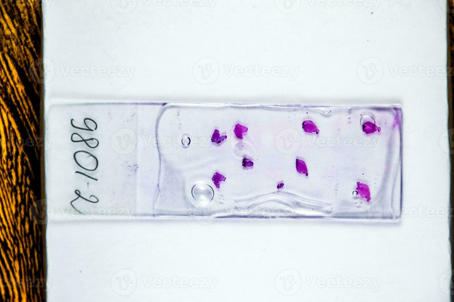 Slices of the tumor under glass. Histological examination of tumor cells for the presence of cancer photo