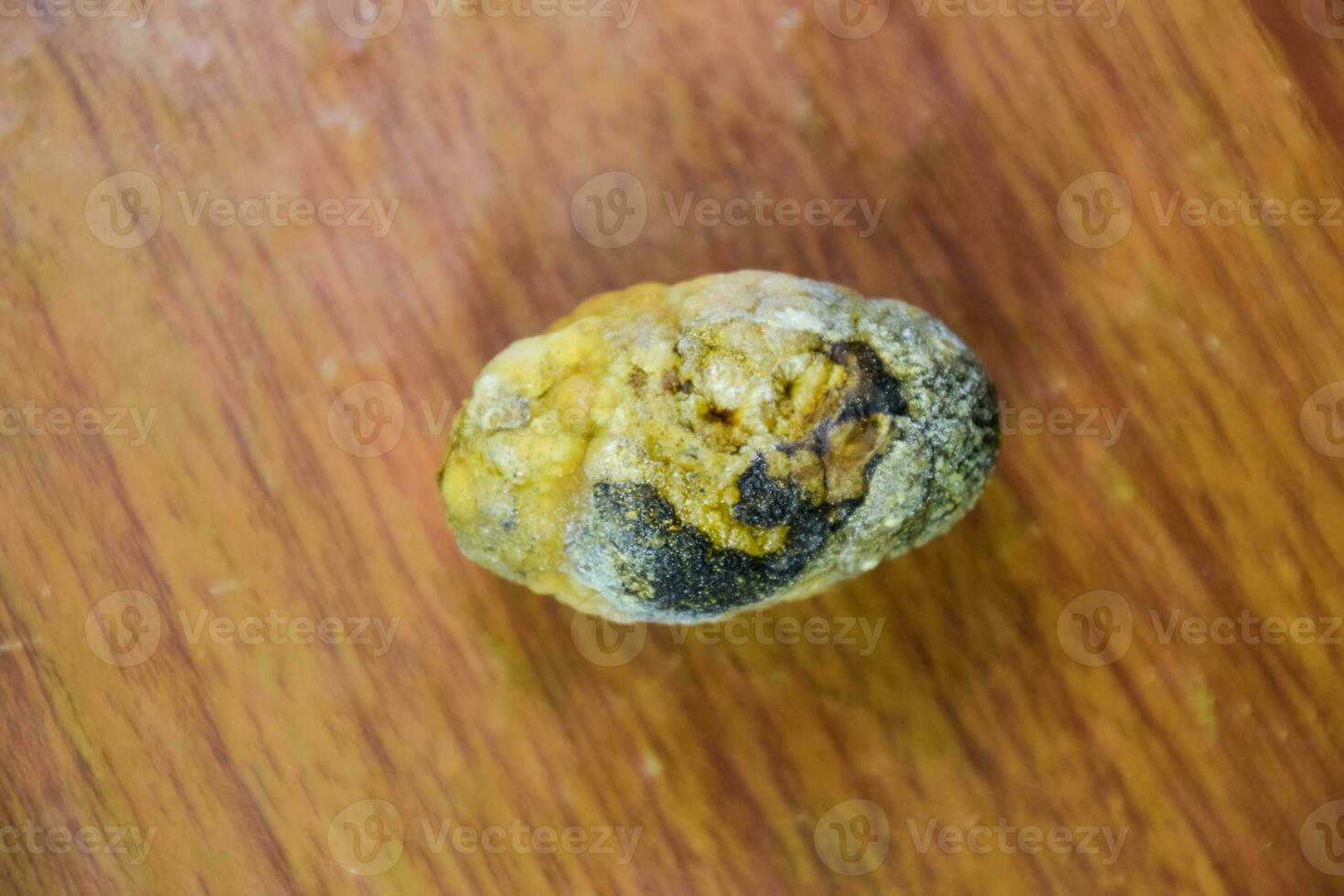 Large gallstone, Gall bladder stone. The result of gallstones photo