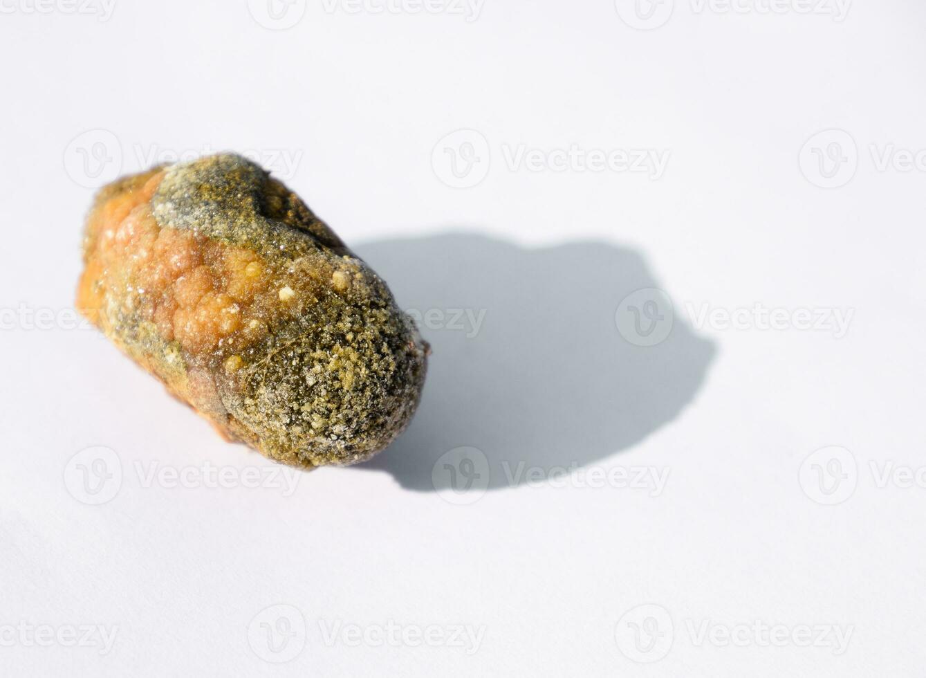 Stone of gallbladder. The result of gallstones. A calculus of heterogeneous composition. photo