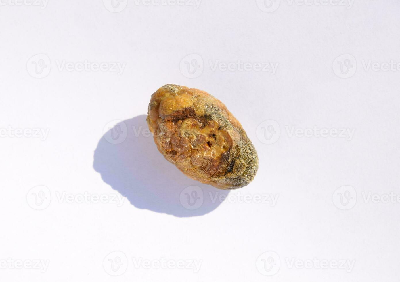 Stone of gallbladder. The result of gallstones. A calculus of heterogeneous composition. photo
