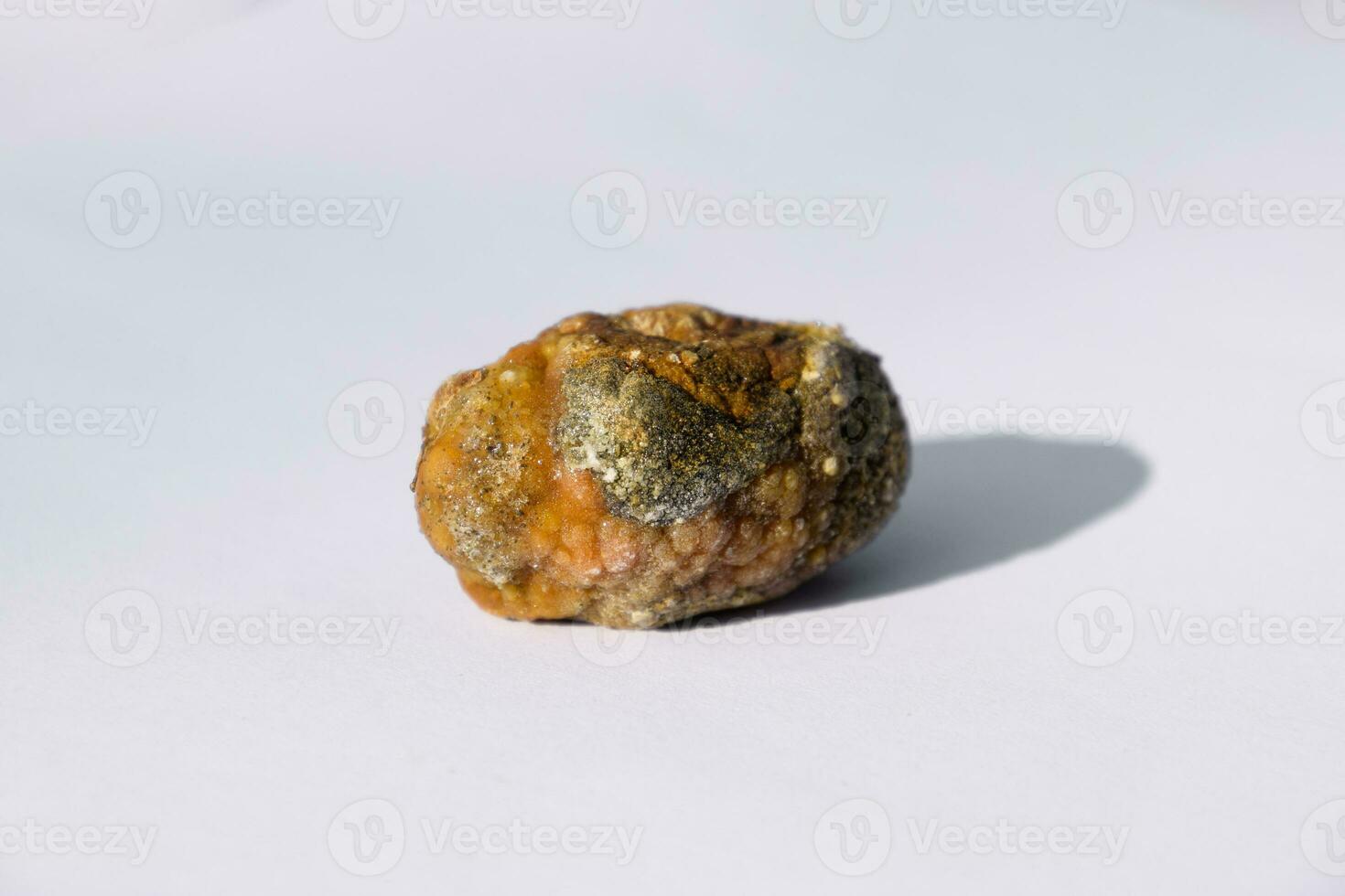 Stone of gallbladder. The result of gallstones. A calculus of heterogeneous composition. photo