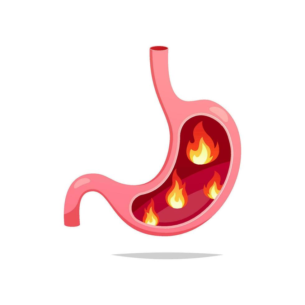 fuego en humano estómago vector aislado en blanco antecedentes.