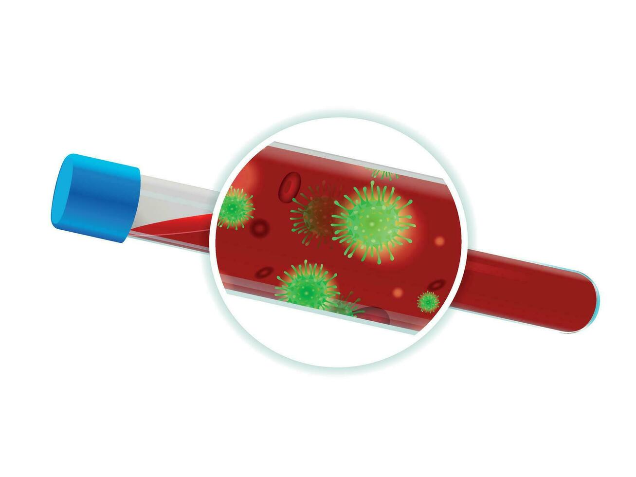 Test tube with blood for analysis. Positive result for the presence of the virus in the blood. Vector illustration.