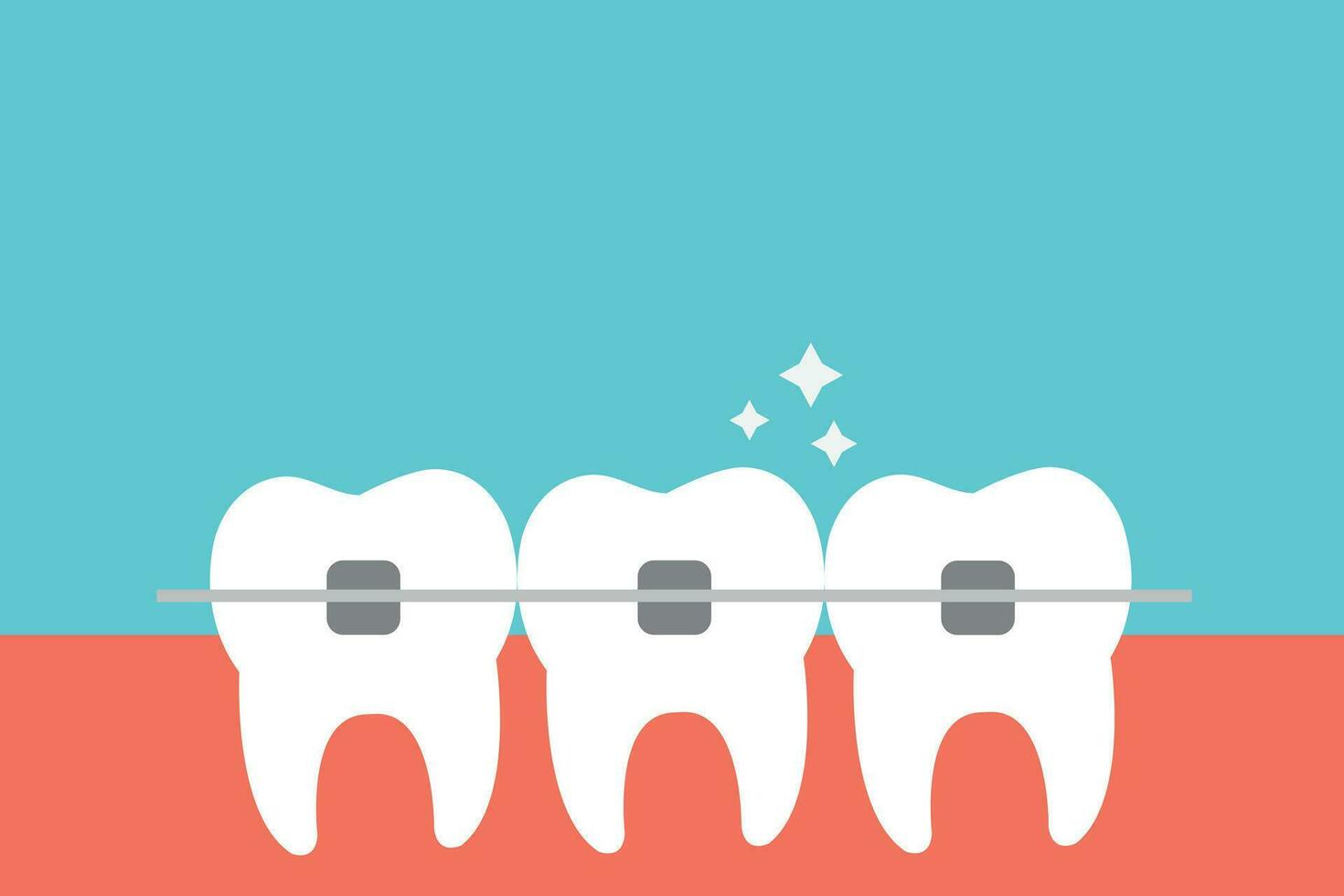 blanco dientes con dental tirantes vector plano ilustración. alineación de mordedura de dientes. dental clínica servicio, cosmético odontología, dientes alisado, y ortodoncia procedimientos concepto.