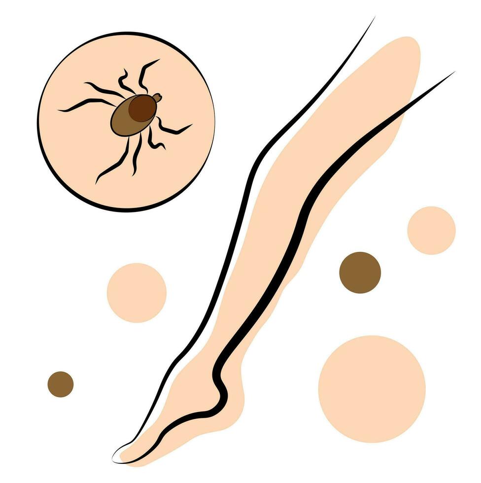 Encephalic mite. Parasite. Nasikomoe vector