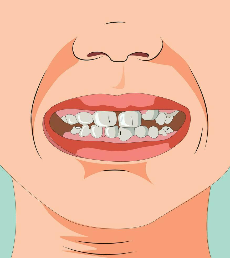 Human mouth illustration showing teeth and nose vector